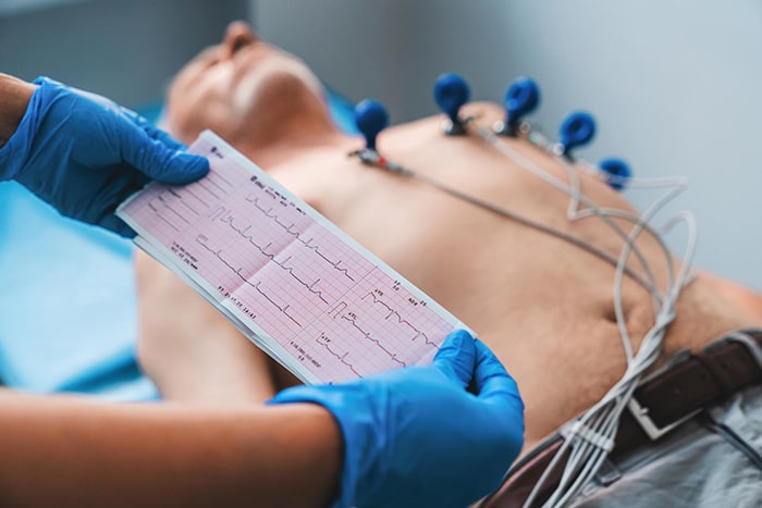 Electrocardiograma Quito Cardiologo Quito-min